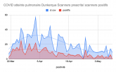 5000 scanners thoraciques effectués en 2 mois dont 3000 pour indication Covid-19