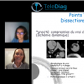 Webinar Aorte Thoracique